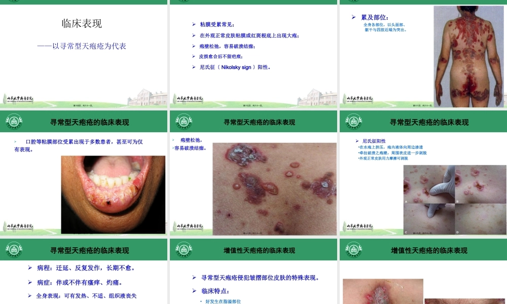 大疱性皮肤病1.pptx