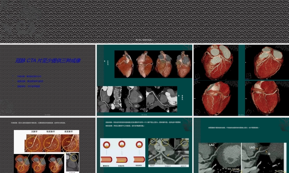 如何看冠脉CTA.ppt