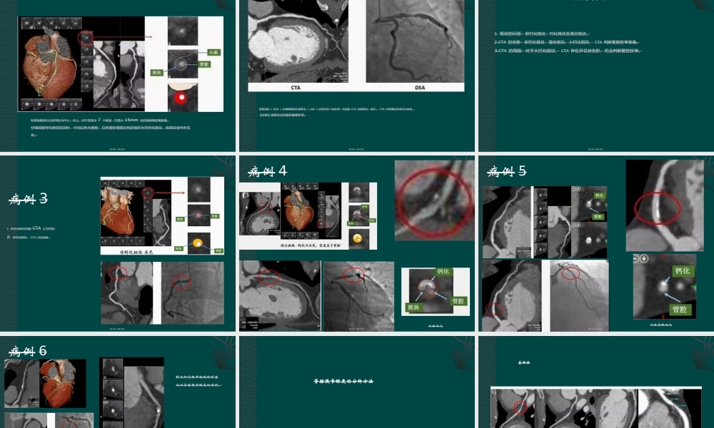 如何看冠脉CTA.ppt
