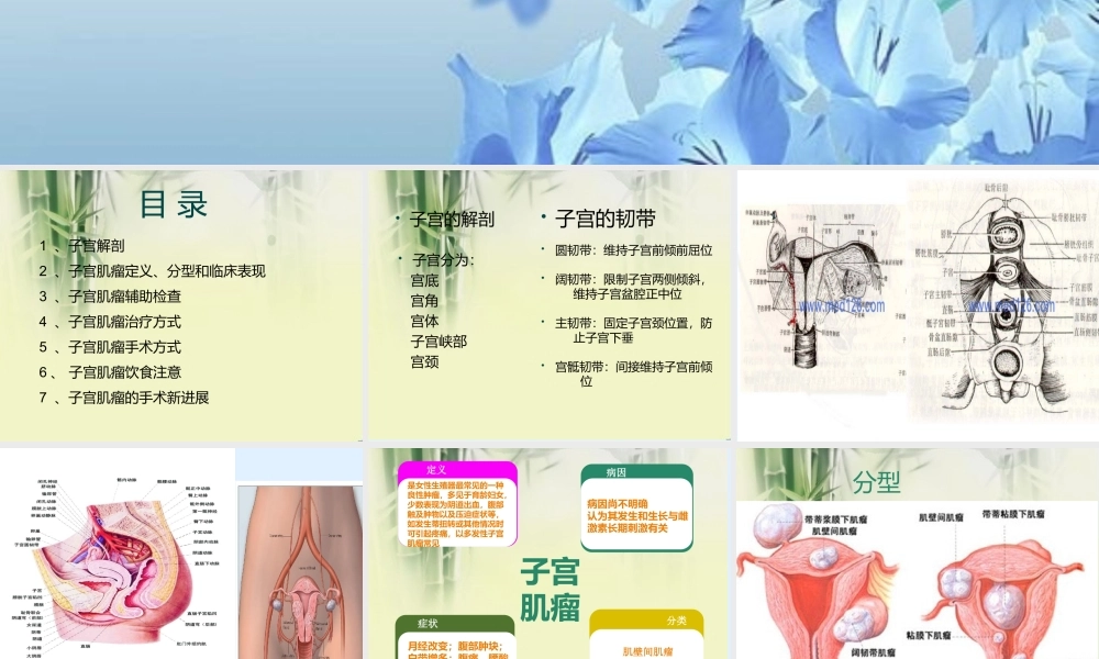 子宫肌瘤+PPT(修改).ppt