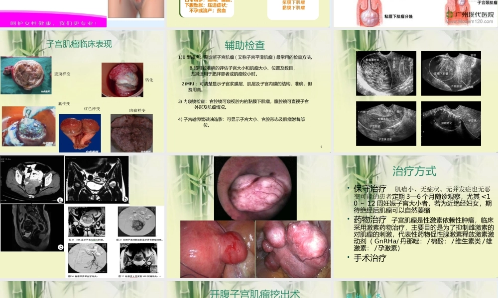 子宫肌瘤+PPT(修改).ppt