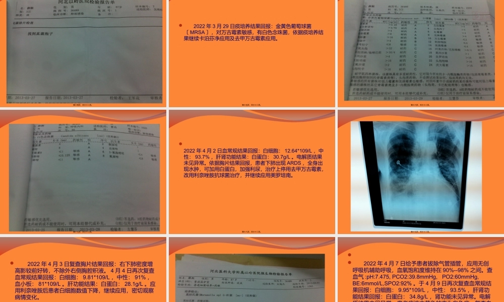 多重耐药菌感染病例分析.pptx