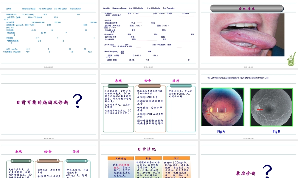 头痛病例讨论.pptx
