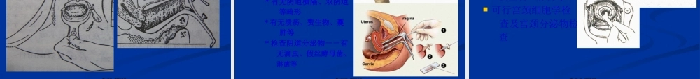 妇科病史及检查.pptx