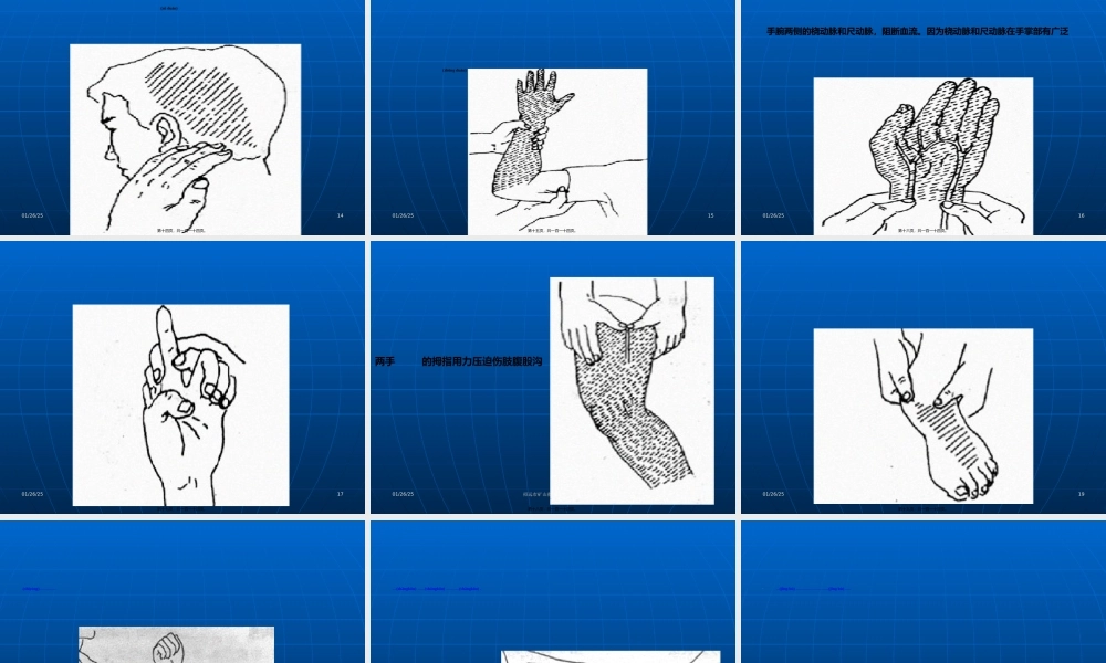 2022年医学专题—创伤急救讲义(新)(1).ppt
