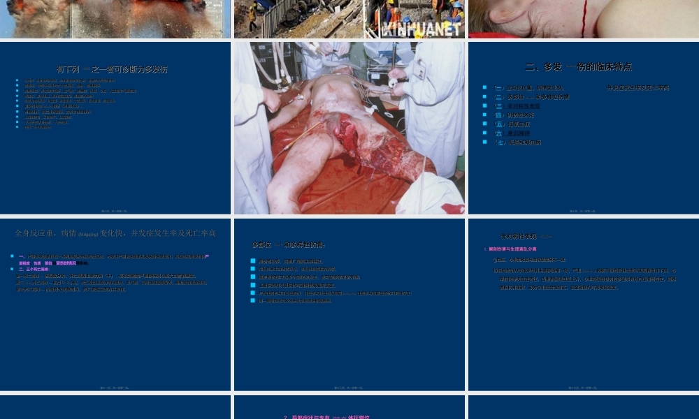 2022年医学专题—多发性创伤.ppt