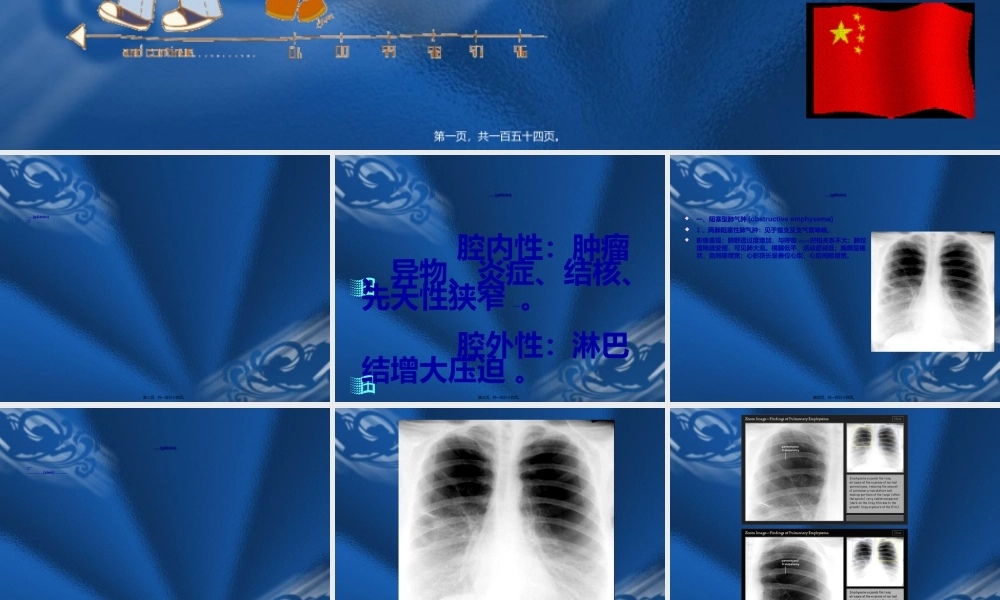 2022年医学专题—呼吸系统基本病变的影像学表现.ppt
