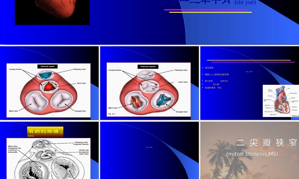 2022年医学专题—心脏瓣膜病-精品.ppt