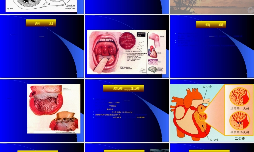 2022年医学专题—心脏瓣膜病-精品.ppt