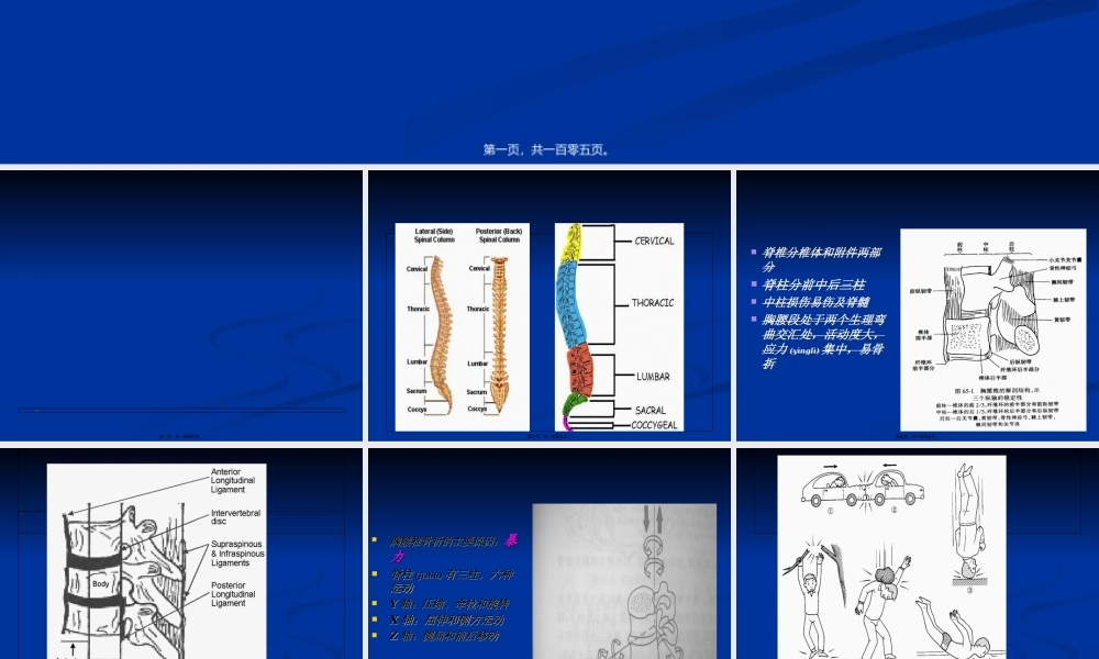 2022年医学专题—脊柱和骨盆骨折骨折.ppt