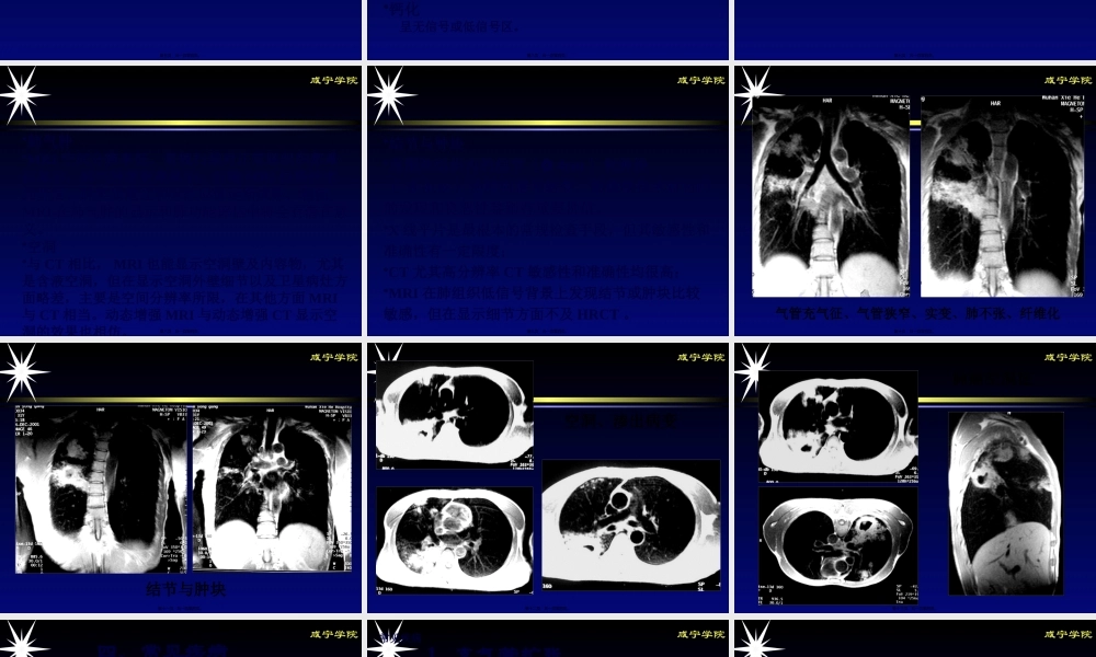 呼吸系统MRI(影像).pptx