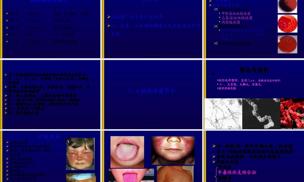 人群重症猪链球菌感染与防制.pptx