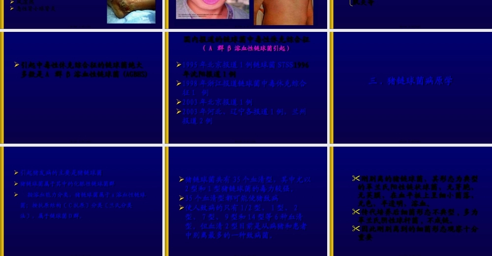 人群重症猪链球菌感染与防制.pptx
