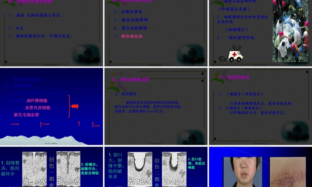 创伤与战伤吴.pptx