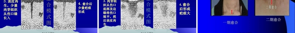 创伤与战伤吴.pptx