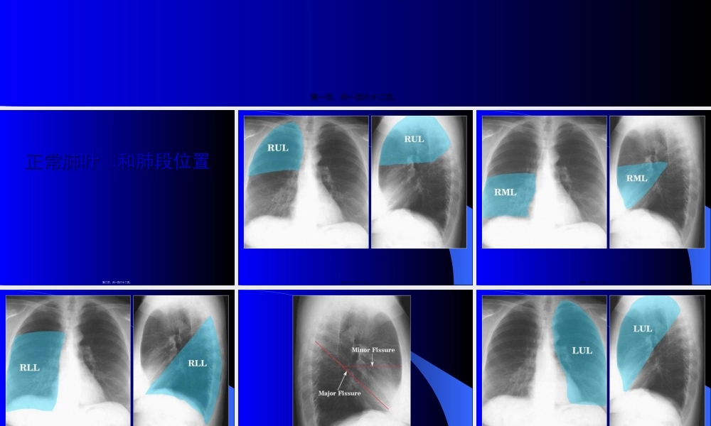 2022年医学专题—胸部X线.ppt
