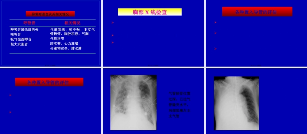 呼吸监护(08-10俞森洋).pptx
