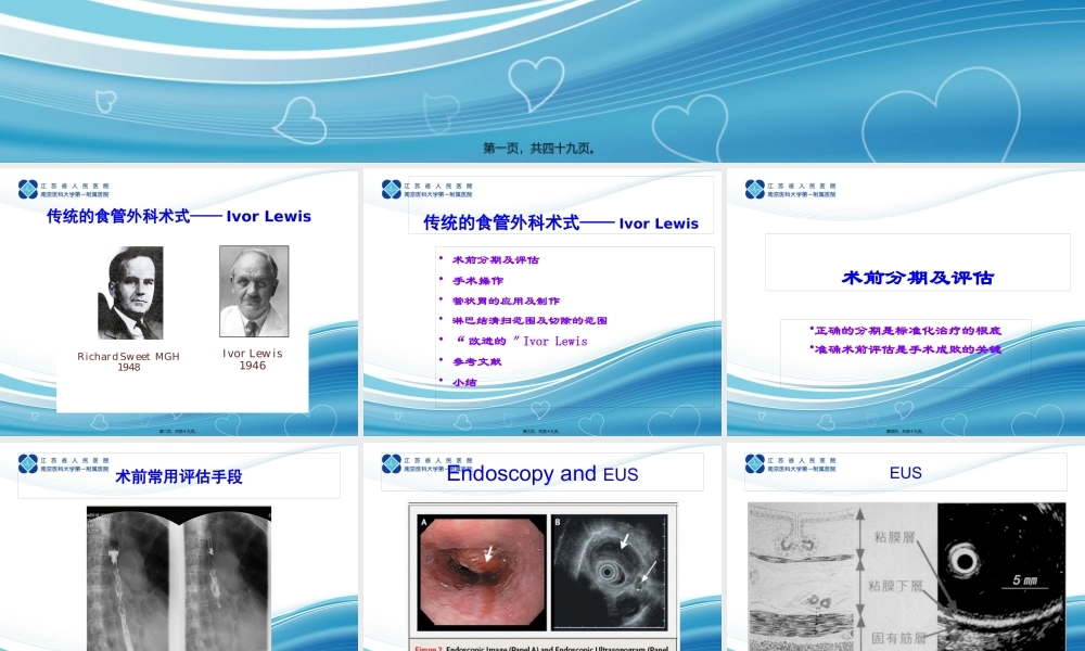 传统的食管外科术式——Ivor-Lewis.pptx