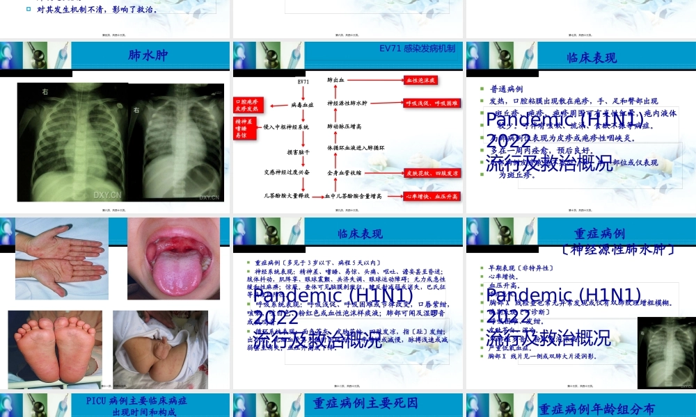 卫生部手足口病诊疗指南版.pptx