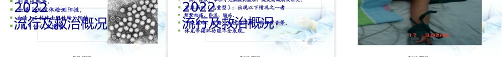 卫生部手足口病诊疗指南版.pptx