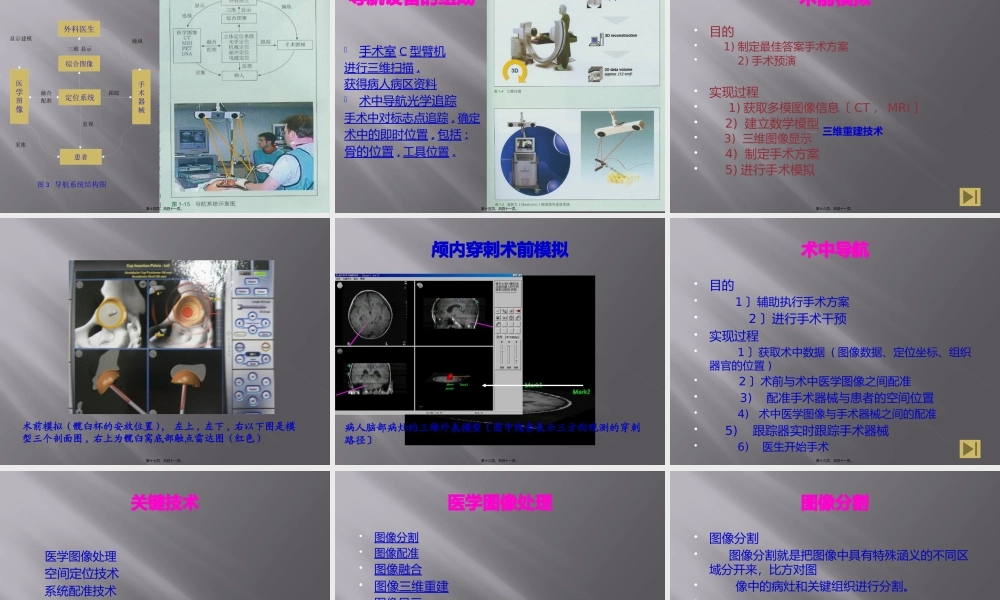 基于图像的外科手术导航系统.pptx