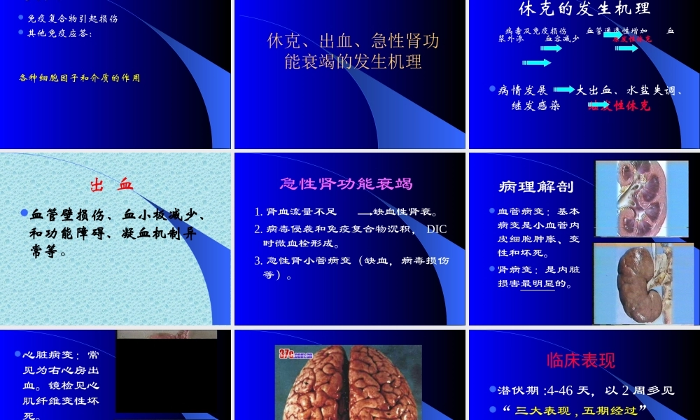 流行性出血热-莫凡.ppt