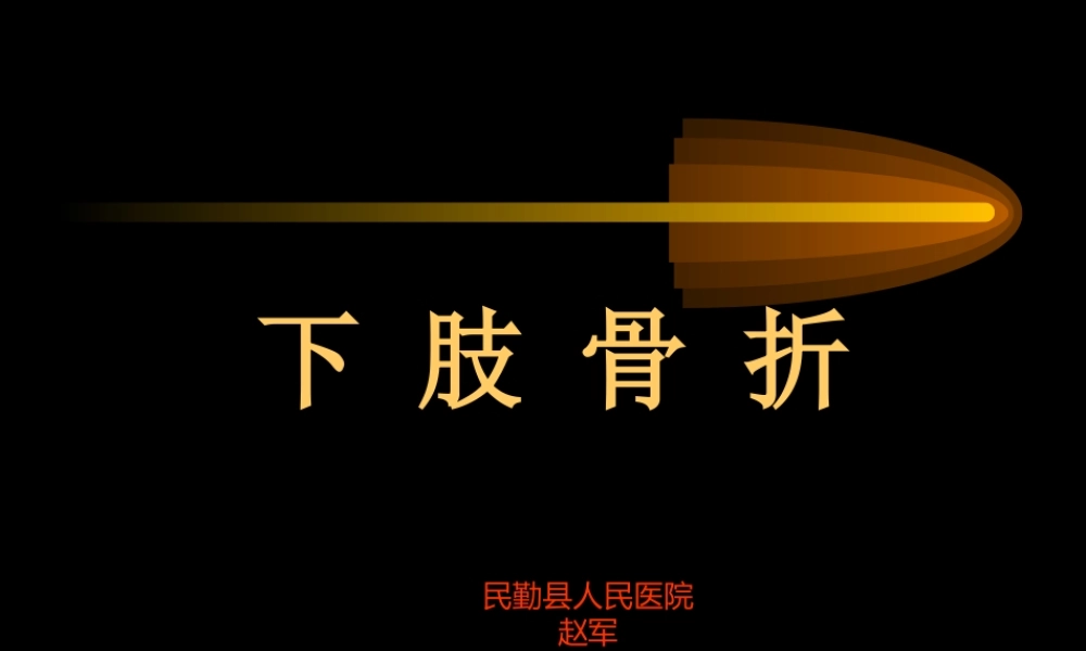 民勤县医院下肢骨折.ppt