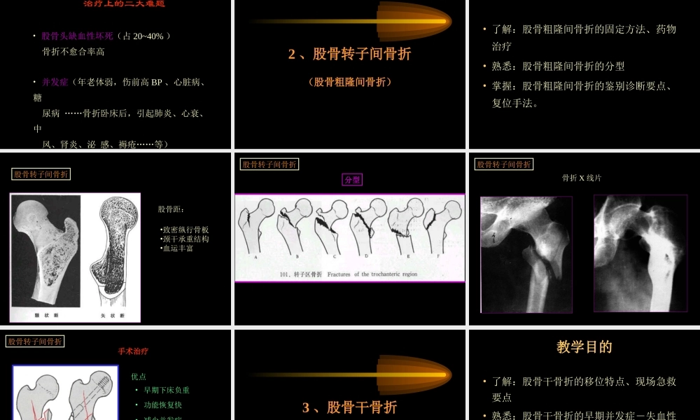 民勤县医院下肢骨折.ppt
