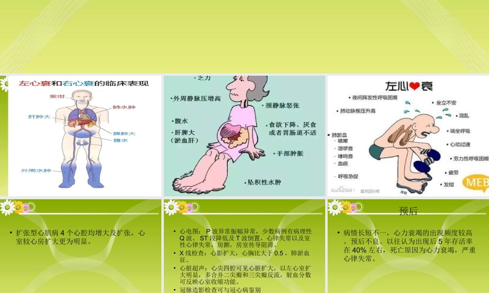 扩张性心肌病第二部分.ppt