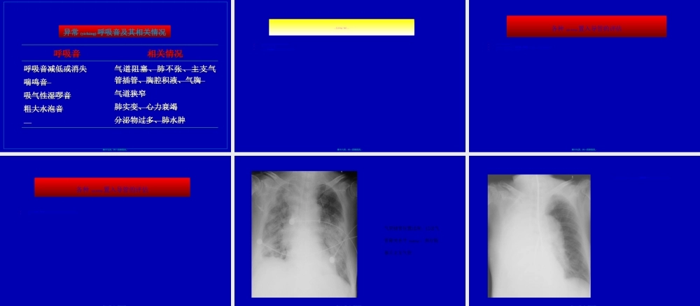 2022年医学专题—呼吸监护(08-10)(1).ppt