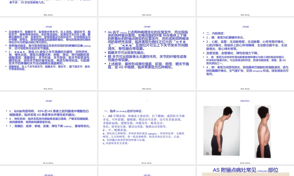 2022年医学专题—强直性脊柱炎的诊治(1).ppt