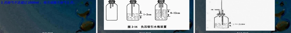 2022年医学专题—小莫自发性气胸(1).ppt