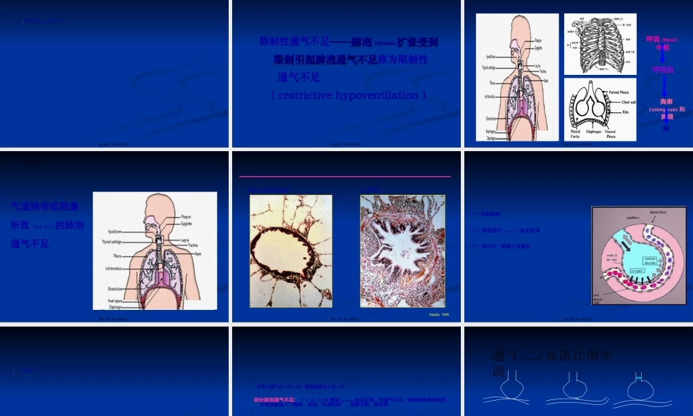 2022年医学专题—慢性呼吸衰竭-浙江大学(1).ppt