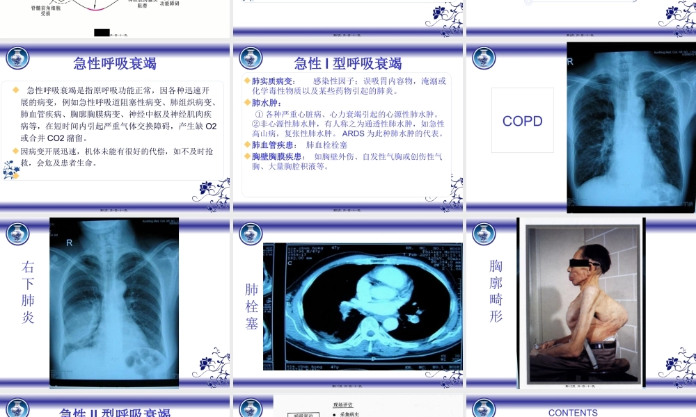呼吸衰竭-洪主任(1).pptx