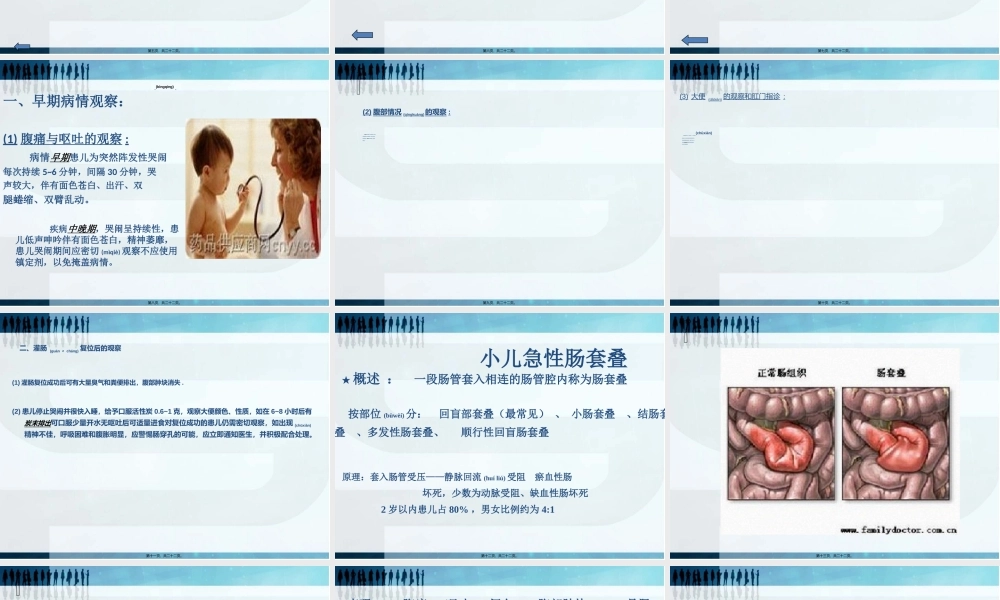 2022年医学专题—小儿肠套叠病情观察-(1)剖析(1).ppt