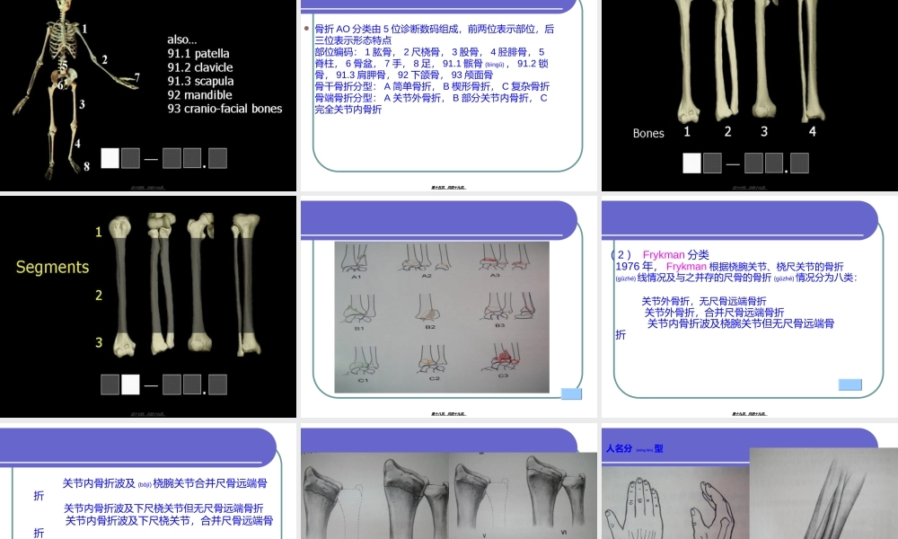 2022年医学专题—桡骨远端骨折(ppt)(1).ppt