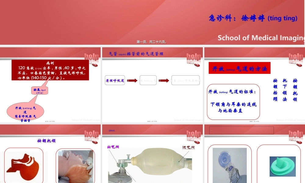 2022年医学专题—气管插管的医护配合(1).ppt