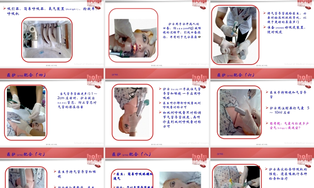 2022年医学专题—气管插管的医护配合(1).ppt