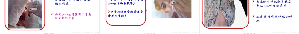2022年医学专题—气管插管的医护配合(1).ppt