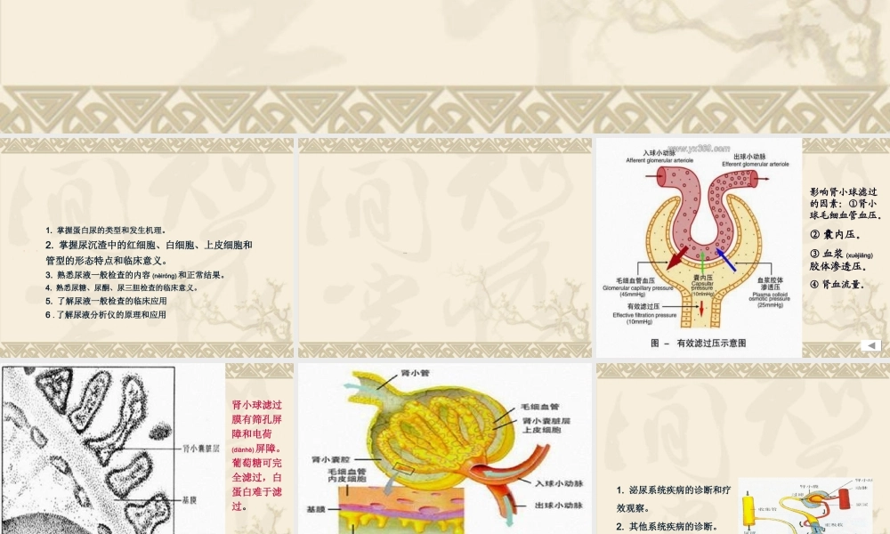 2022年医学专题—第五章尿液一般检验(1).ppt