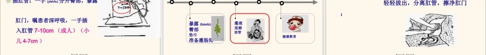 2022年医学专题—灌肠法-—大量不保留灌肠-保留灌肠(1).ppt