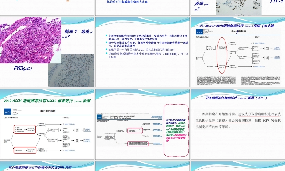 2022年医学专题—肺癌个体化检测及质控(1).ppt