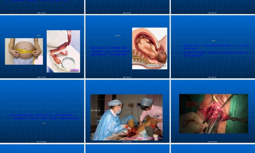 2022年医学专题—肩难产的处理(1).ppt