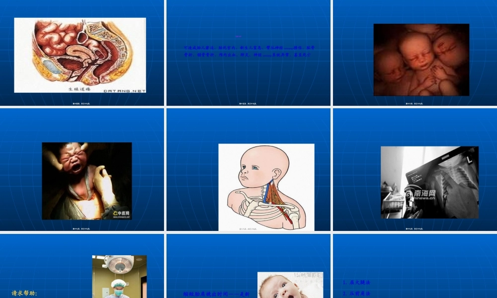 2022年医学专题—肩难产的处理(1).ppt