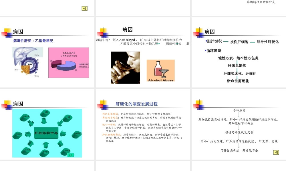 [整理后]肝硬化的理(1).ppt