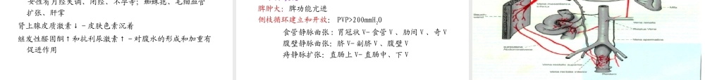 [整理后]肝硬化的理(1).ppt