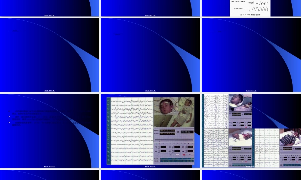2022年医学专题—癫痫的脑电图(1).ppt