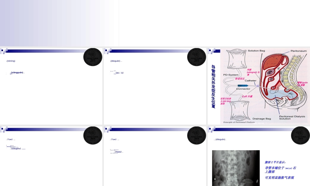 2022年医学专题—腹膜透析非感染并发症(1).ppt