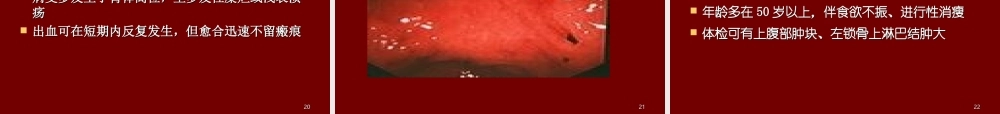 上消化道出血33.ppt