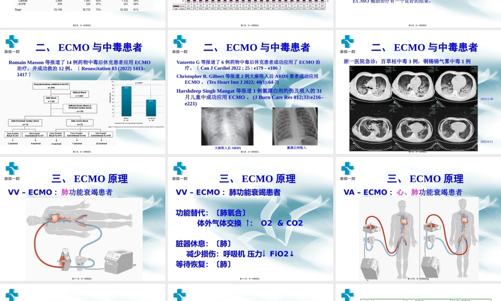 体外膜肺氧合.pptx